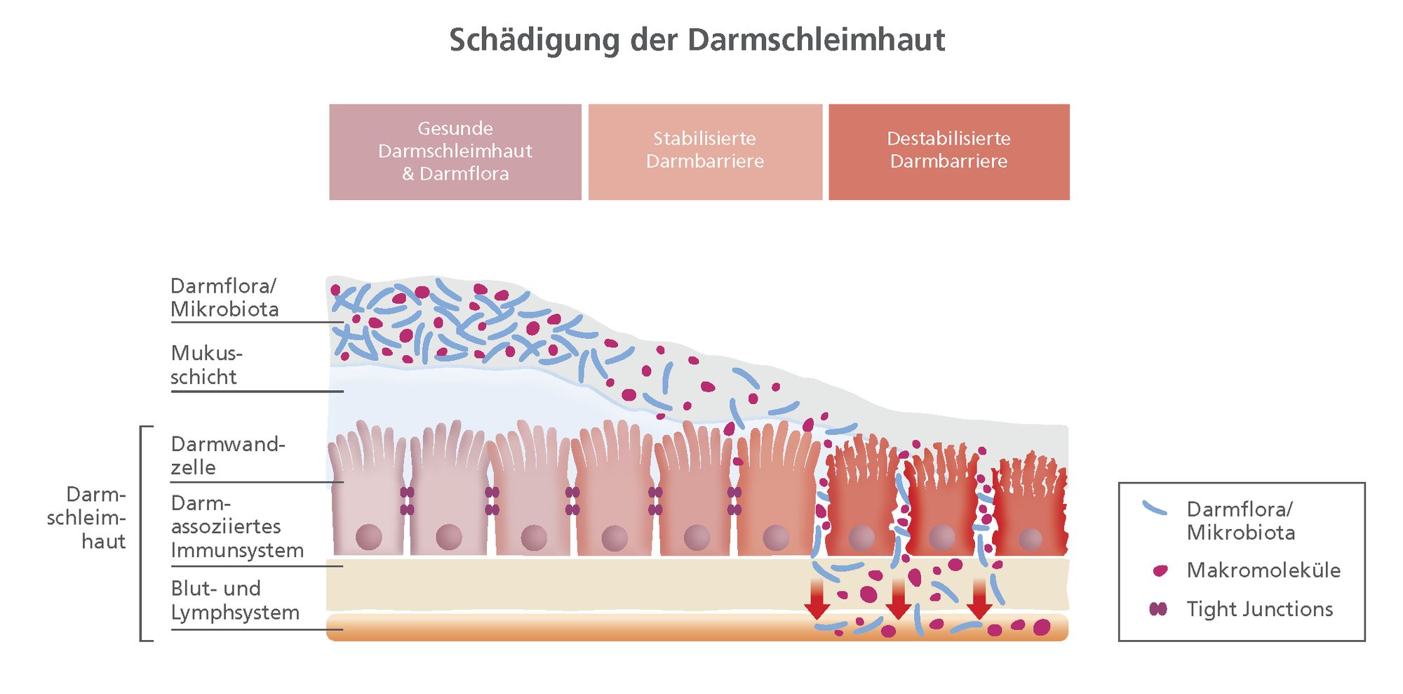 Schädigung der Darmschleimhaut / Gastroenterologe empfiehlt: Bei anhaltenden Verdauungsbeschwerden Darmbarriere prüfen lassen / Weiterer Text über ots und www.presseportal.de/nr/7139 / Die Verwendung dieses Bildes ist für redaktionelle Zwecke unter Beachtung ggf. genannter Nutzungsbedingungen honorarfrei. Veröffentlichung bitte mit Bildrechte-Hinweis.
